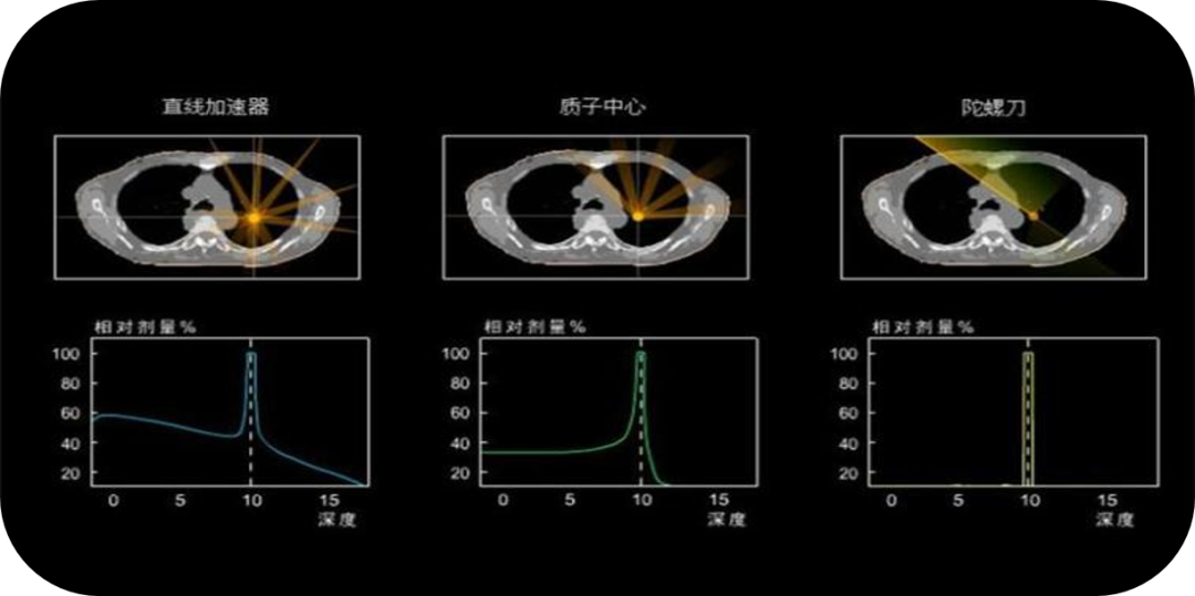 Comparison of radiotherapy technologies: Linear Accelerator vs Proton Center vs Gyro Knife — showing dose distribution and beam precision